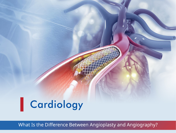 What Is the Difference Between Angioplasty and Angiography?