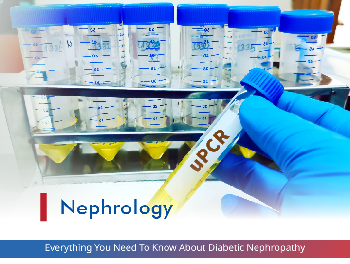 Everything You Need To Know About Diabetes Nephropathy