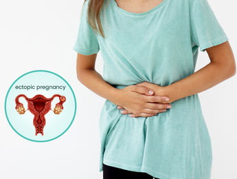 Ectopic Pregnancy