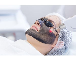 Hollywood Peel